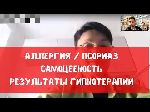 Аллергия, псориаз, самоценность. Гипнотерапия отзыв